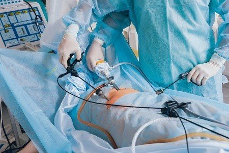 Best Laparoscopic Surgery in New Delhi