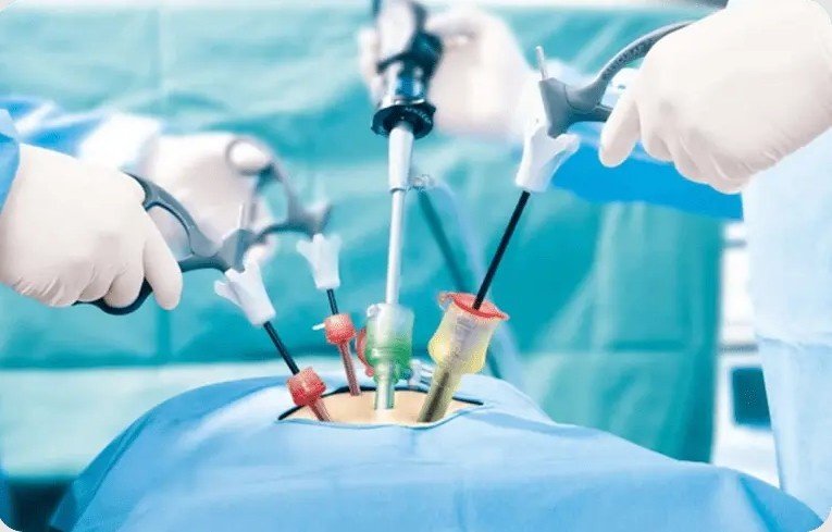 Best Laparoscopic Hernia Surgeon in Dwarka
