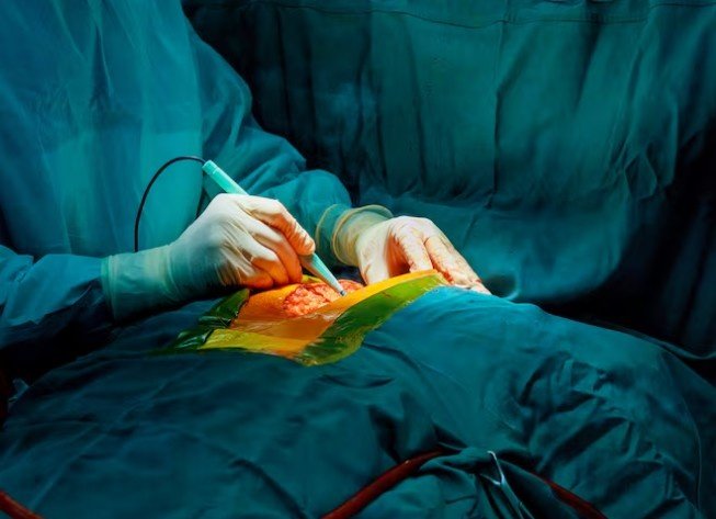 Best Laparoscopic Appendix Surgeon in North Delhi