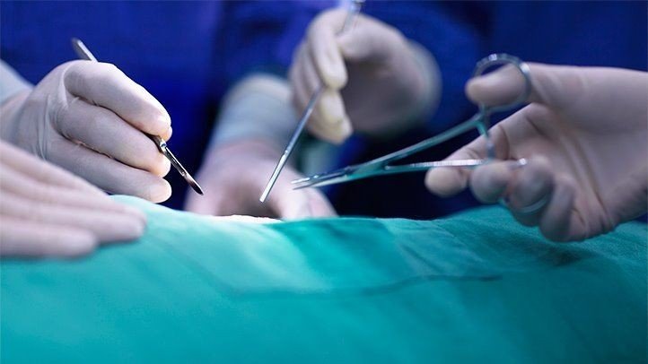 Best Laparoscopic Appendix Surgery in Dwarka