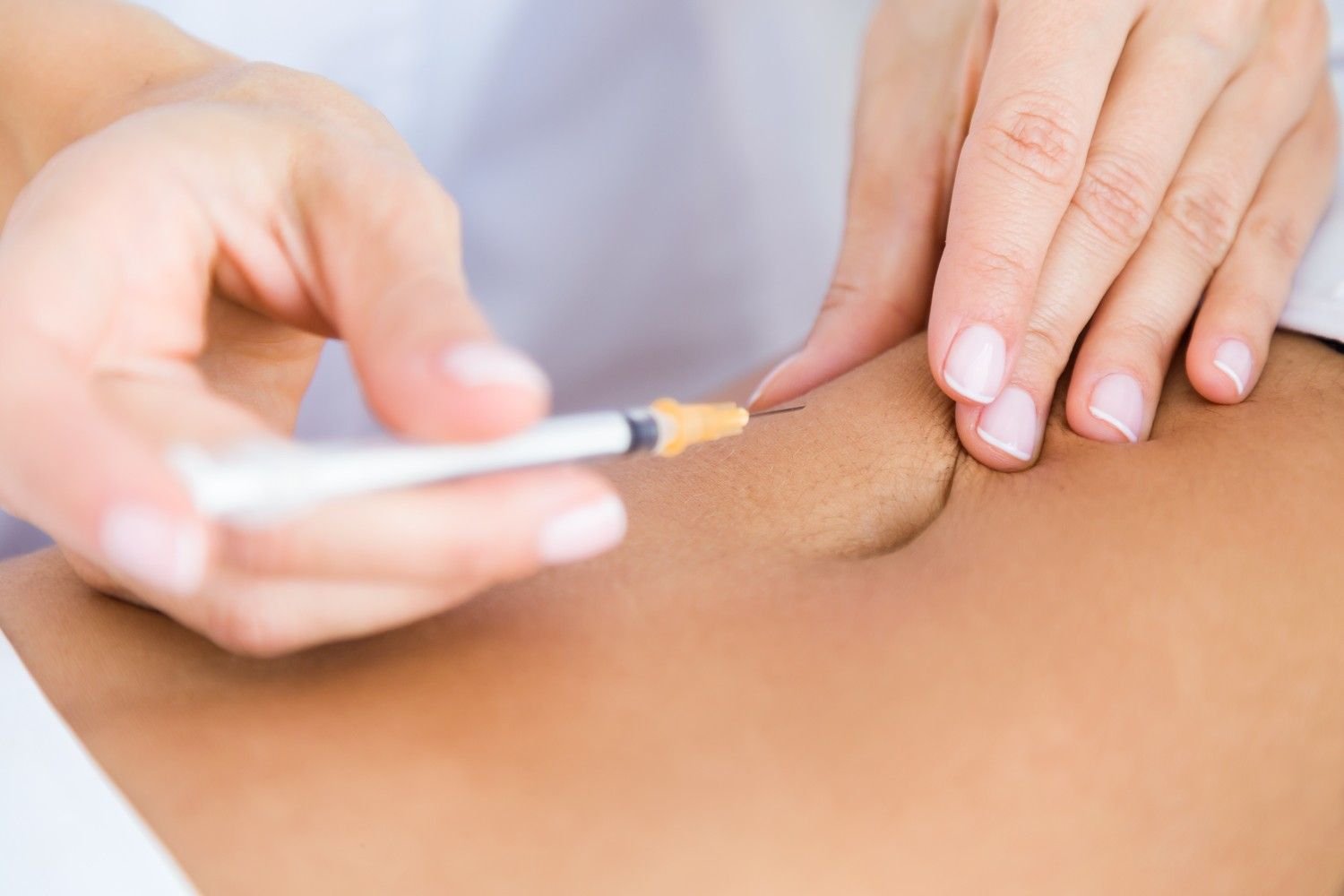 Best Lipoma Treatment in New Delhi